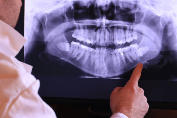 Best Broken Tooth Emergency  in Davie, FL